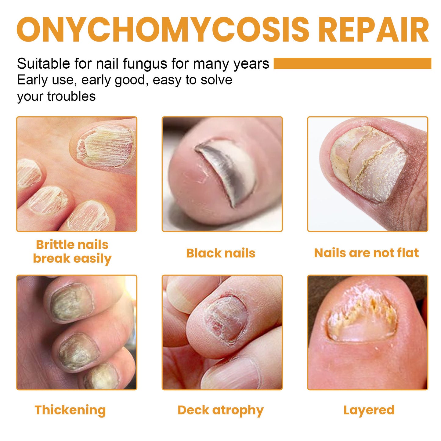 Nail Repair Patch Repair Ingrown Nail