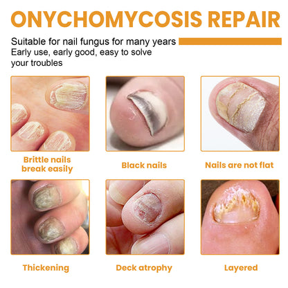 Nail Repair Patch Repair Ingrown Nail